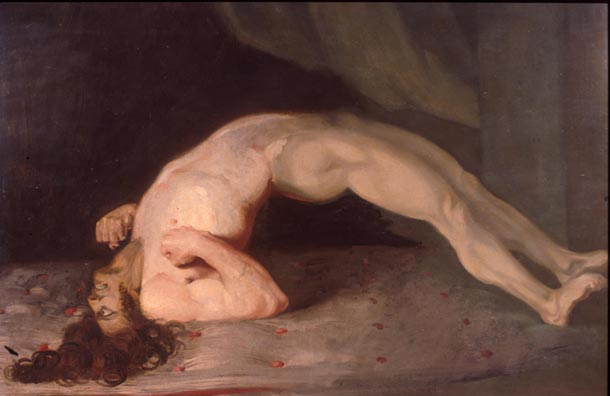 opisthotonus_in_a_patient_suffering_from_tetanus_-_painting_by_sir_charles_bell_-_1809